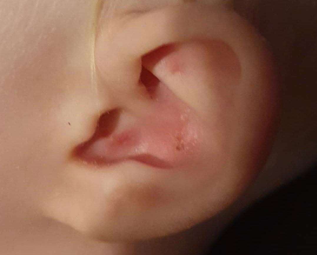 Richie's ear after he scratched himself. Picture: Margaret Thorn