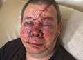 Man left with horrific injuries in unprovoked attack