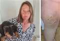 Woman bitten in terrifying dog attack