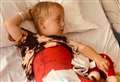 Boy, 4, stuck in huge cast after breaking leg at nursery