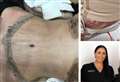 'My clinic's full of botched Turkish surgery victims...'