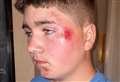 Boy injured after biker ‘deliberately’ swerves at him