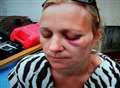 Mum punched by drunk bus passenger