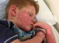 Boy 'in agony' from mystery rash