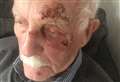 Strangers rush to aid grandad after nasty fall 