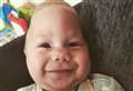 Family’s plea for help ahead of baby's skull surgery