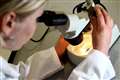 Blindness from some inherited eye diseases may be caused by gut bacteria – study