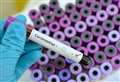Coronavirus cases up 70% since April 