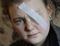 Schoolgirl's eye pierced by pencil thrown during maths class
