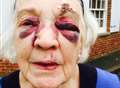 Call to improve pavement after woman hurt in fall