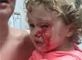 Toddler’s horrific eye injury in freak store accident
