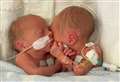 ‘Miraculous’ rare twins born dangerously early reunited