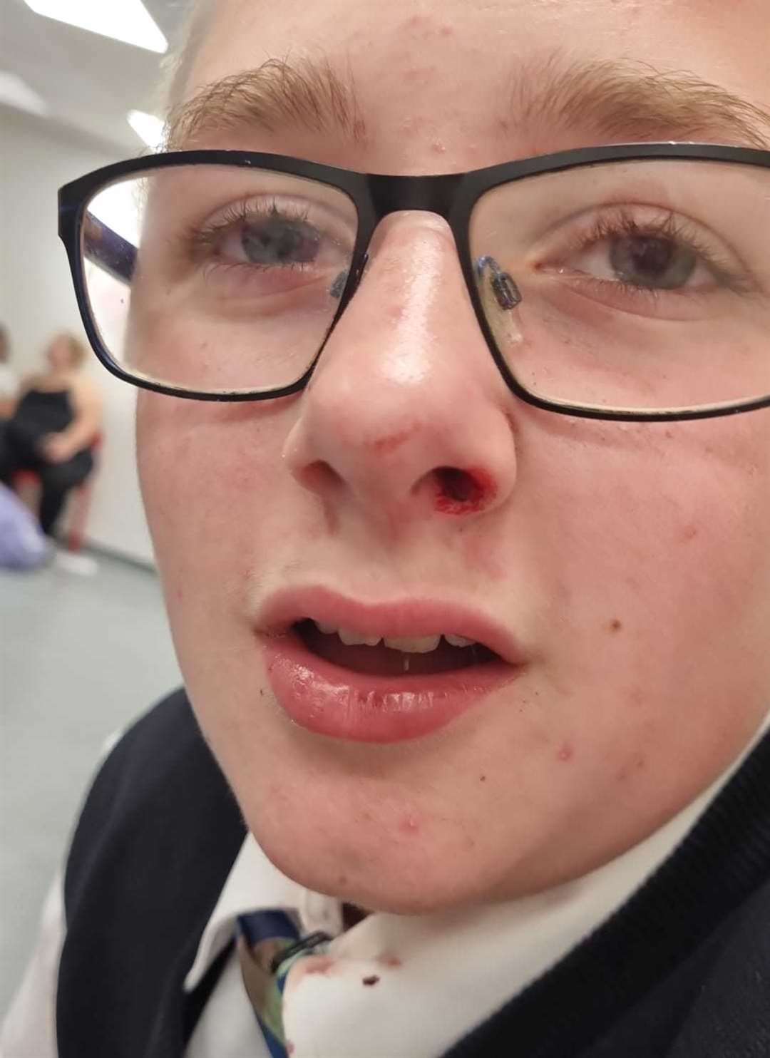 Aidan was punched in the face at Brompton Academy. Picture: Stephanie Parsons