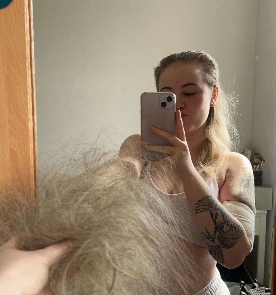 Roxanne shaved her head after losing chunks of hair to chemotherapy