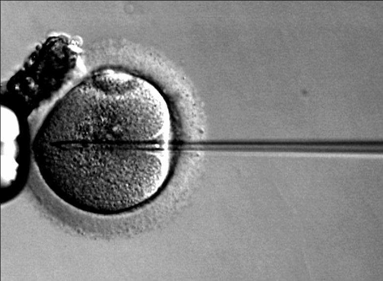 A microscopic view of an IVF procedure. Stock picture