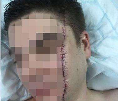 A man's face was slashed at the Prince of Wales pub