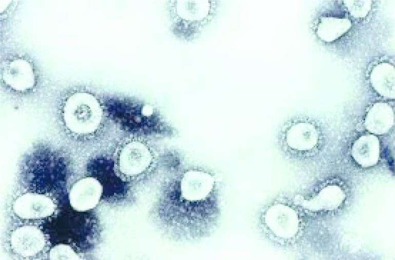 Mass killer: The COVID-19 virus