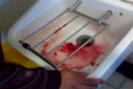 A man is seen spitting blood in a sink after the attack. Picture: Sunday Mirror