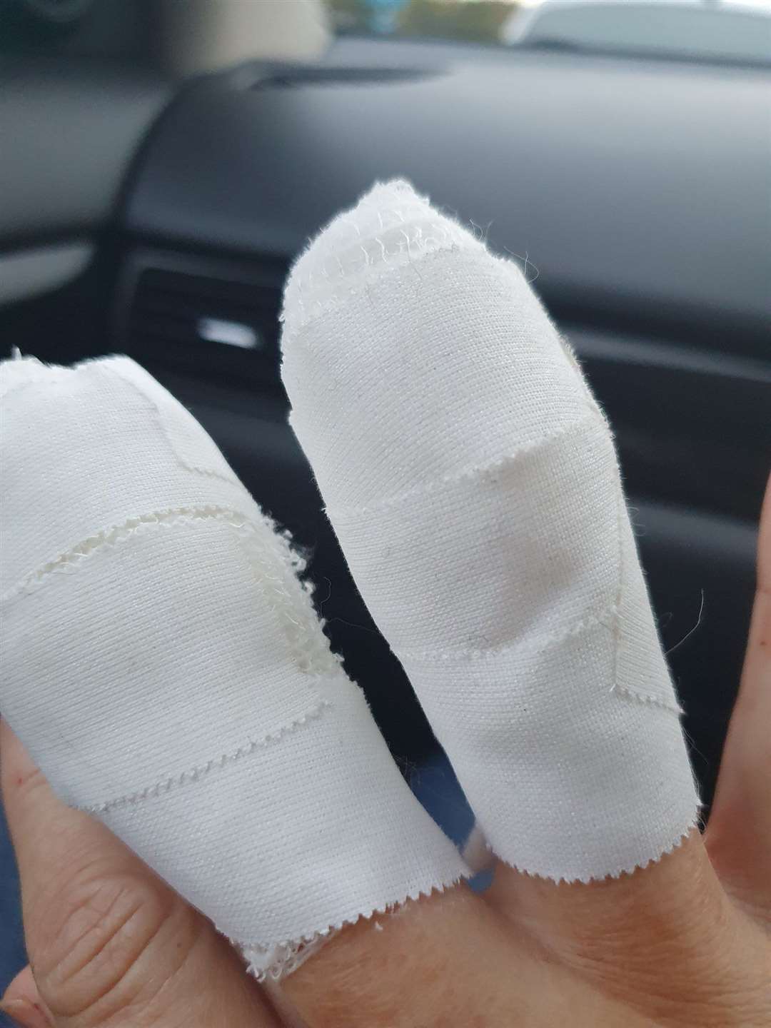 Cllr Carnac shared a pic of her bandaged up fingers. Picture: Rachel Carnac/Twitter