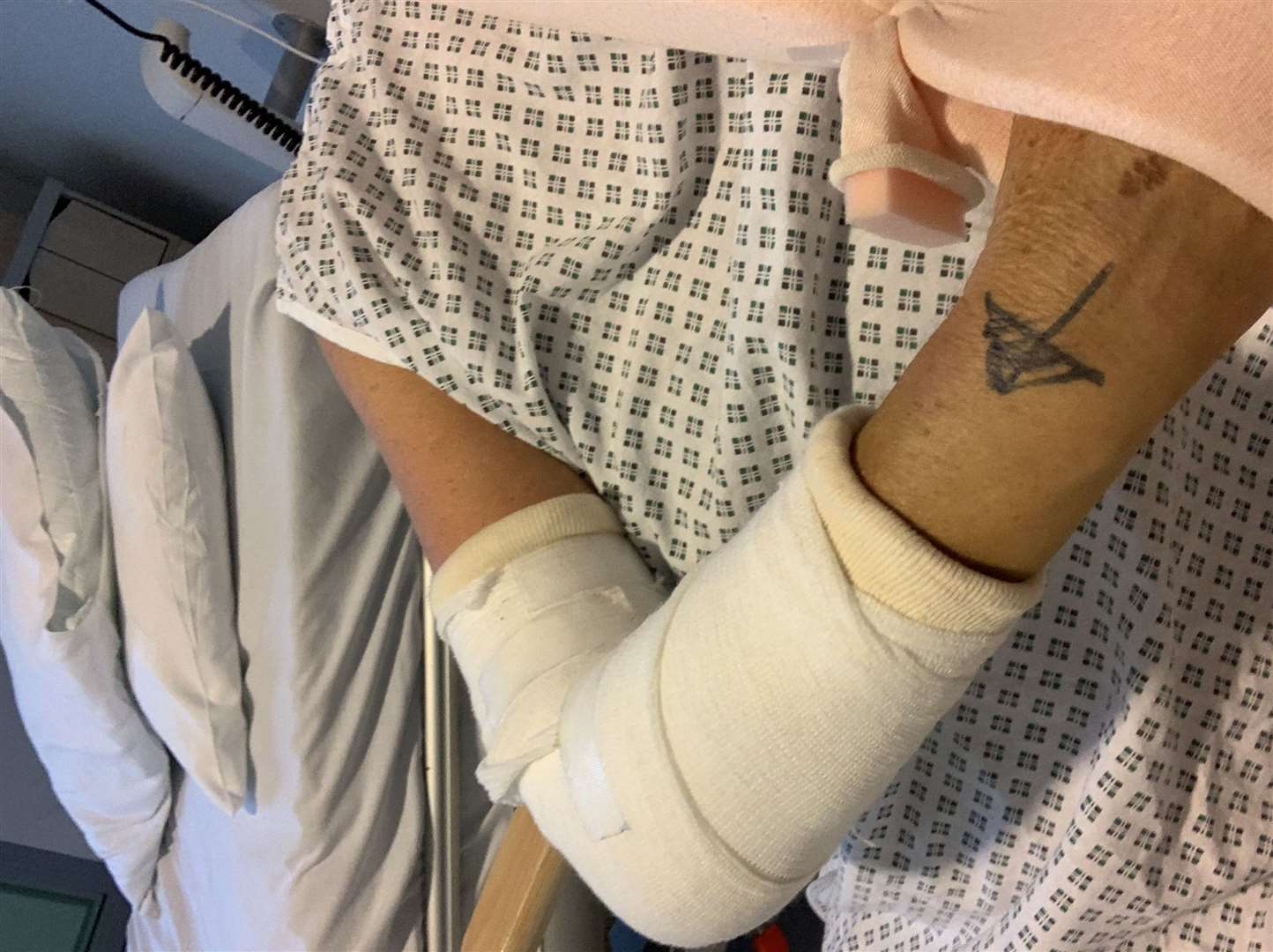 Mrs Harper broke her elbow when she fell over last October. Picture: Suzanne Harper