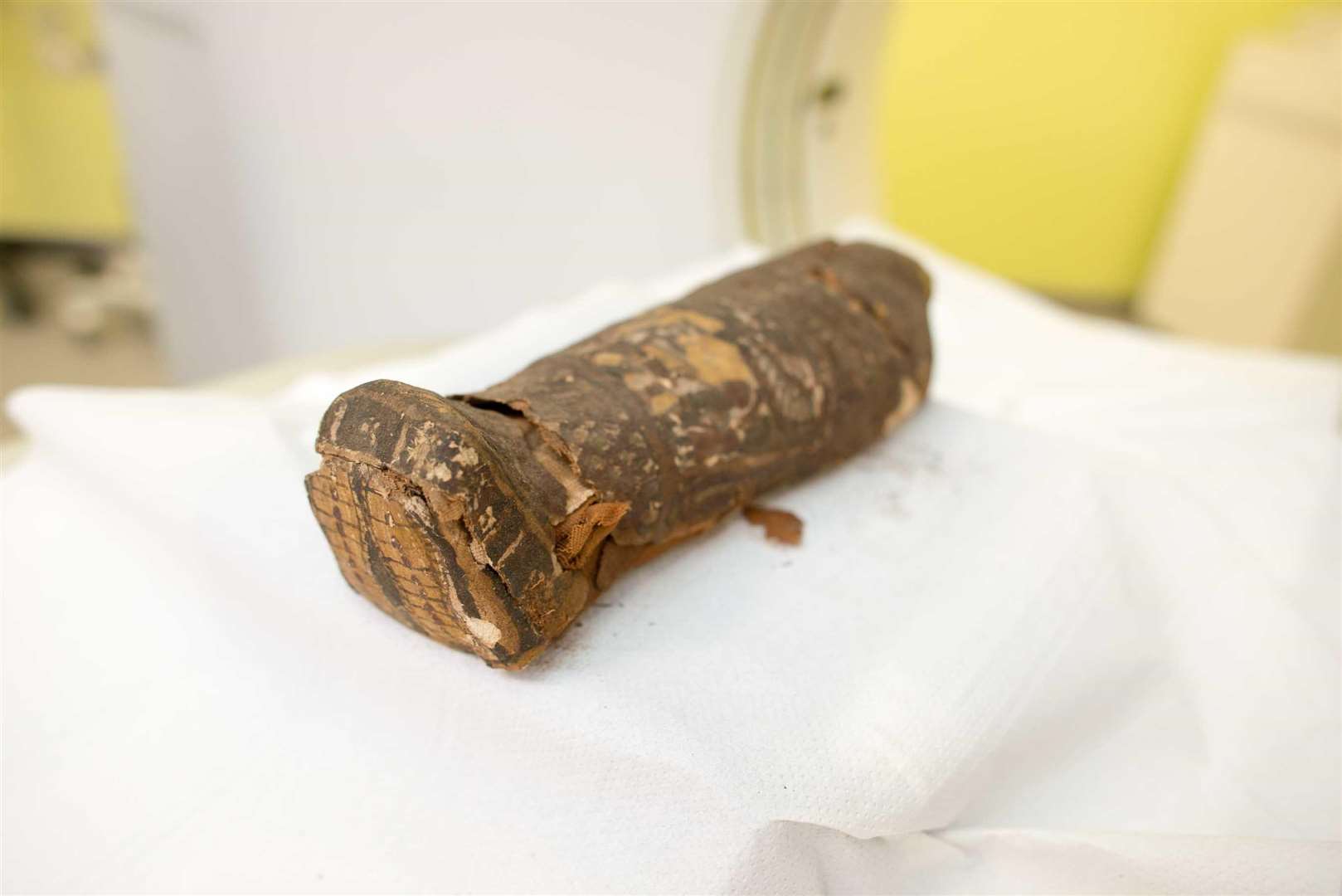 A rare anencephalic baby mummy in the museum’s collections (2306611)