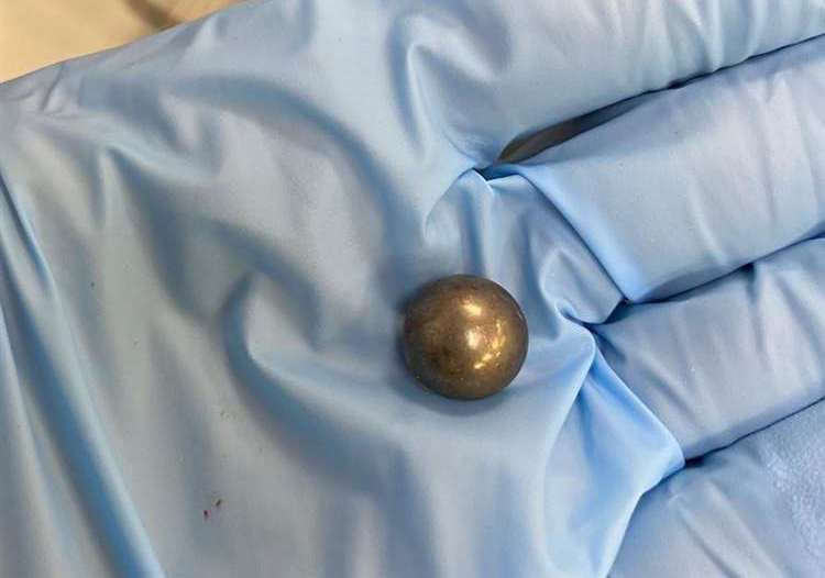 The ball bearing which hit rescue cat Trousers in Ashford
