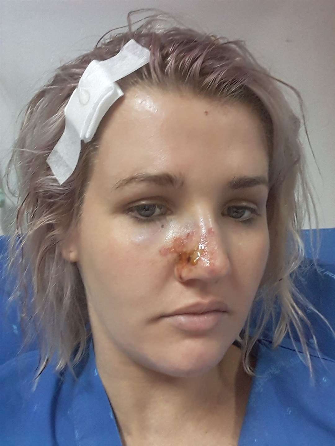 Abi Harrison had to pay a £12,000 medical bill as her insurance did not cover emergency surgery