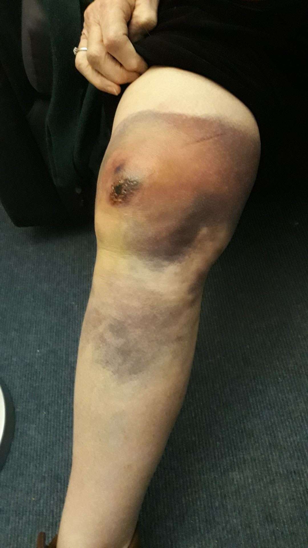 The pensioner’s knee was badly injured in the attack (Northumbria Police/PA)