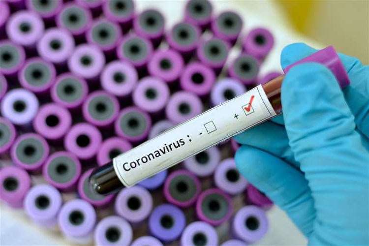 COVID-19 cases in the country continue to rise