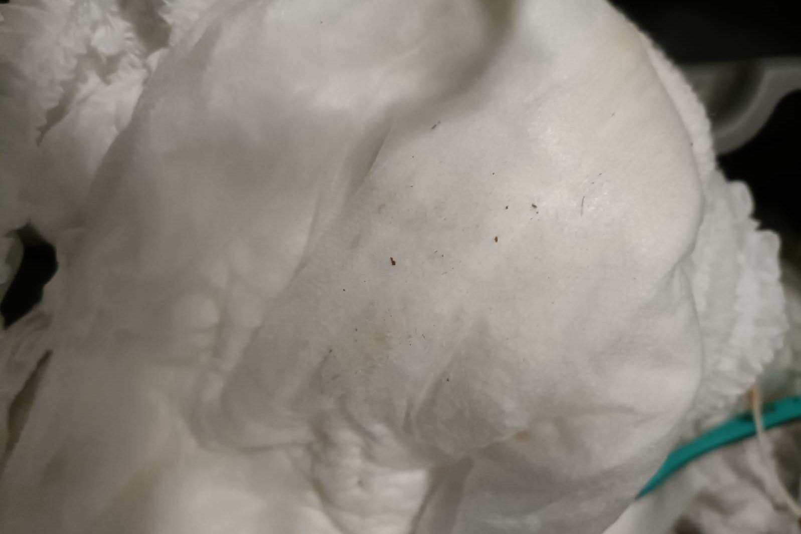 The bed bugs on Sally's incontinence pads