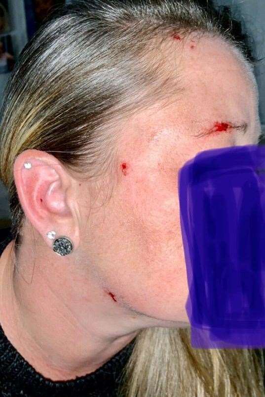 Mrs Urquhart suffered injuries to the head after the glass shattered on her