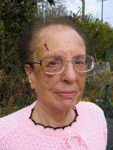 Jean Thomas, who suffered horrific injuries after being attacked by burglars in her Staplehurst home