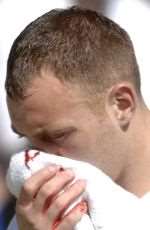 Gillingham captain Barry Fuller suffered a broken nose against Leeds