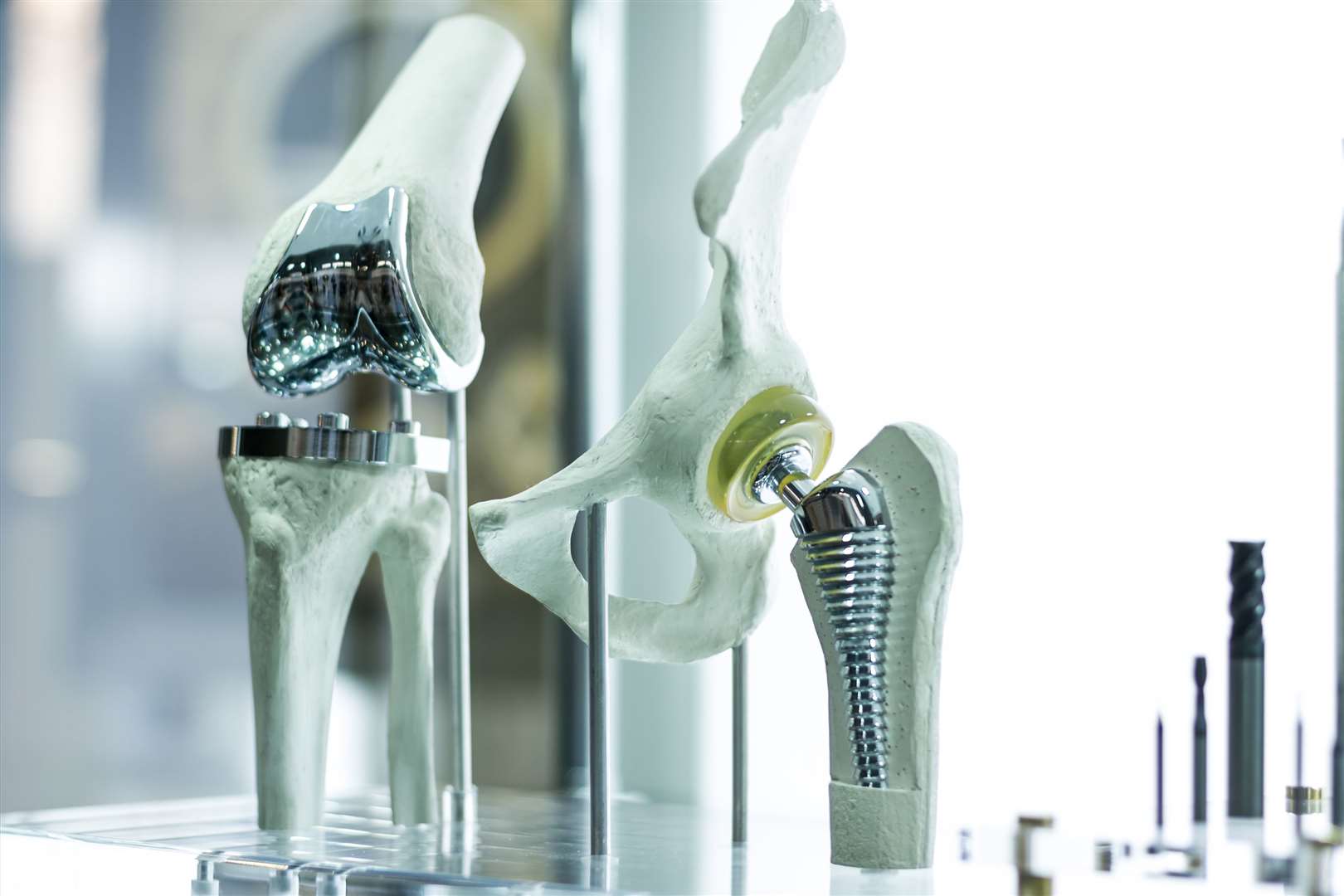 The metal from hip and knee prosthetics can be recycled