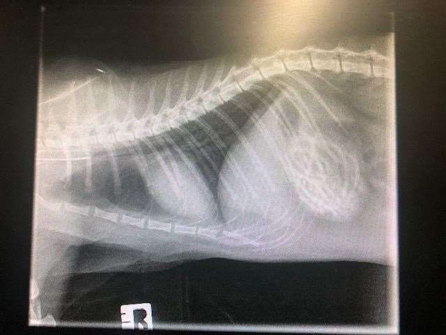 An x-ray showing the hairbands in his stomach