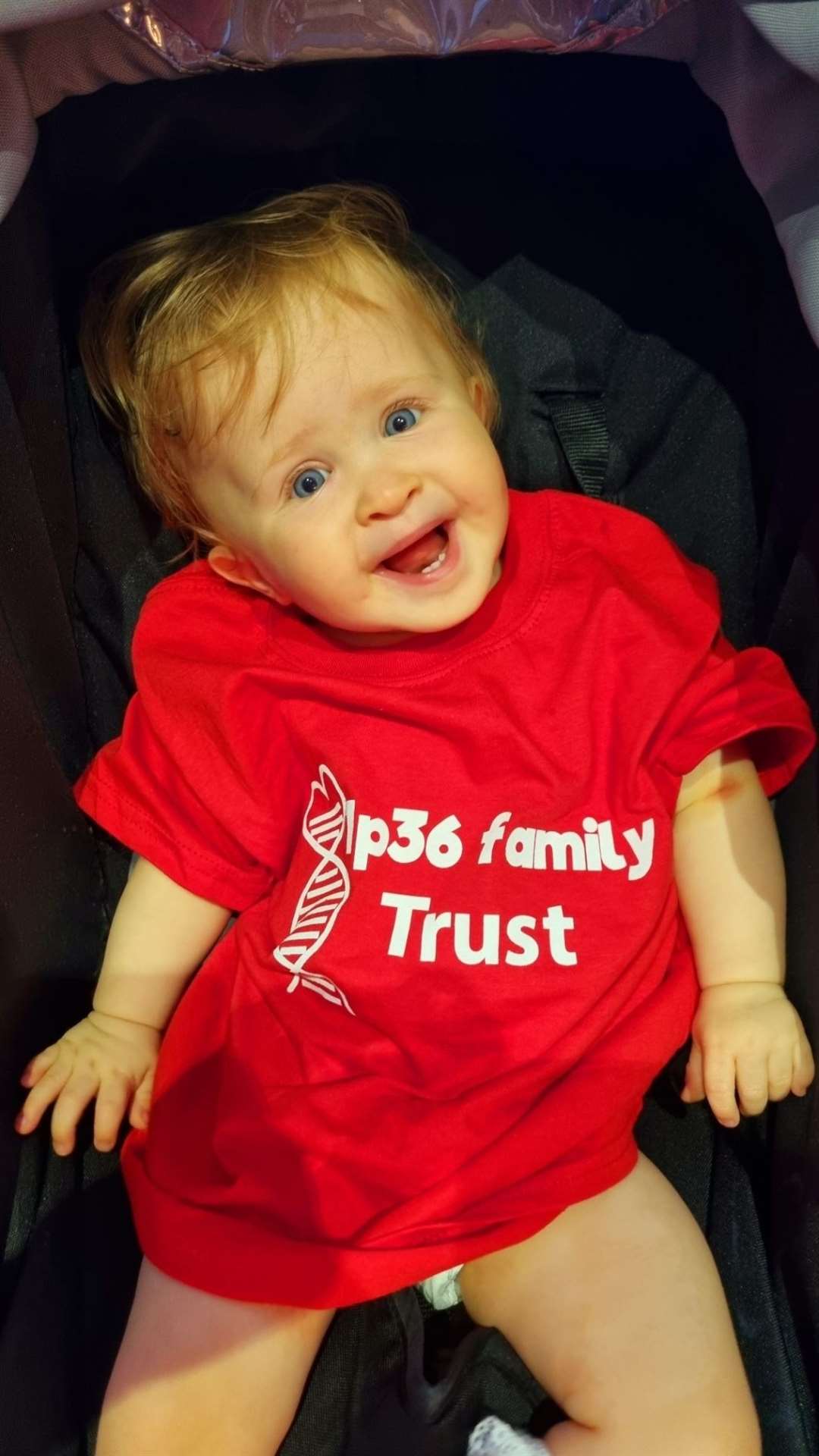 Rosie has a rare genetic condition called 1p36