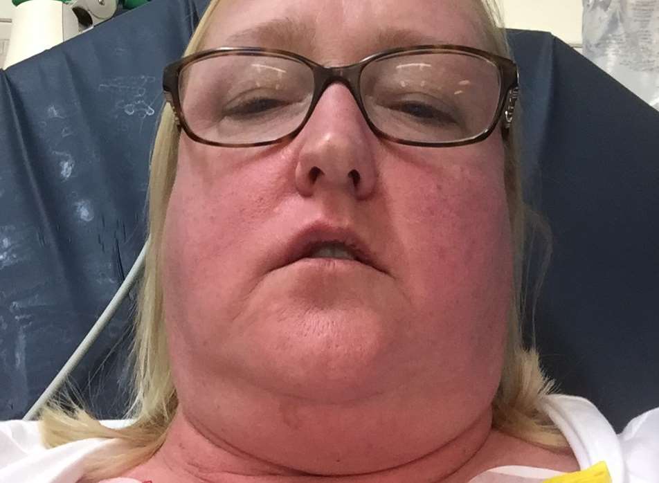Tina Hill at hospital after she was stung by bees in a field near Grove Road