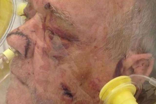 Ex-Merchant Navy sailor Kenneth Seymour was battered at his home in Margate, suffering fractures of the nose, head and back