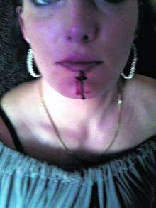 Road rage victim Lindsey Martin whose cut lip is believed to have been caused by a ring