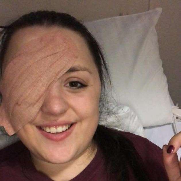 Still smiling: Ella Wolff underwent surgery to remove her eye following a cancer diagnosis in 2018