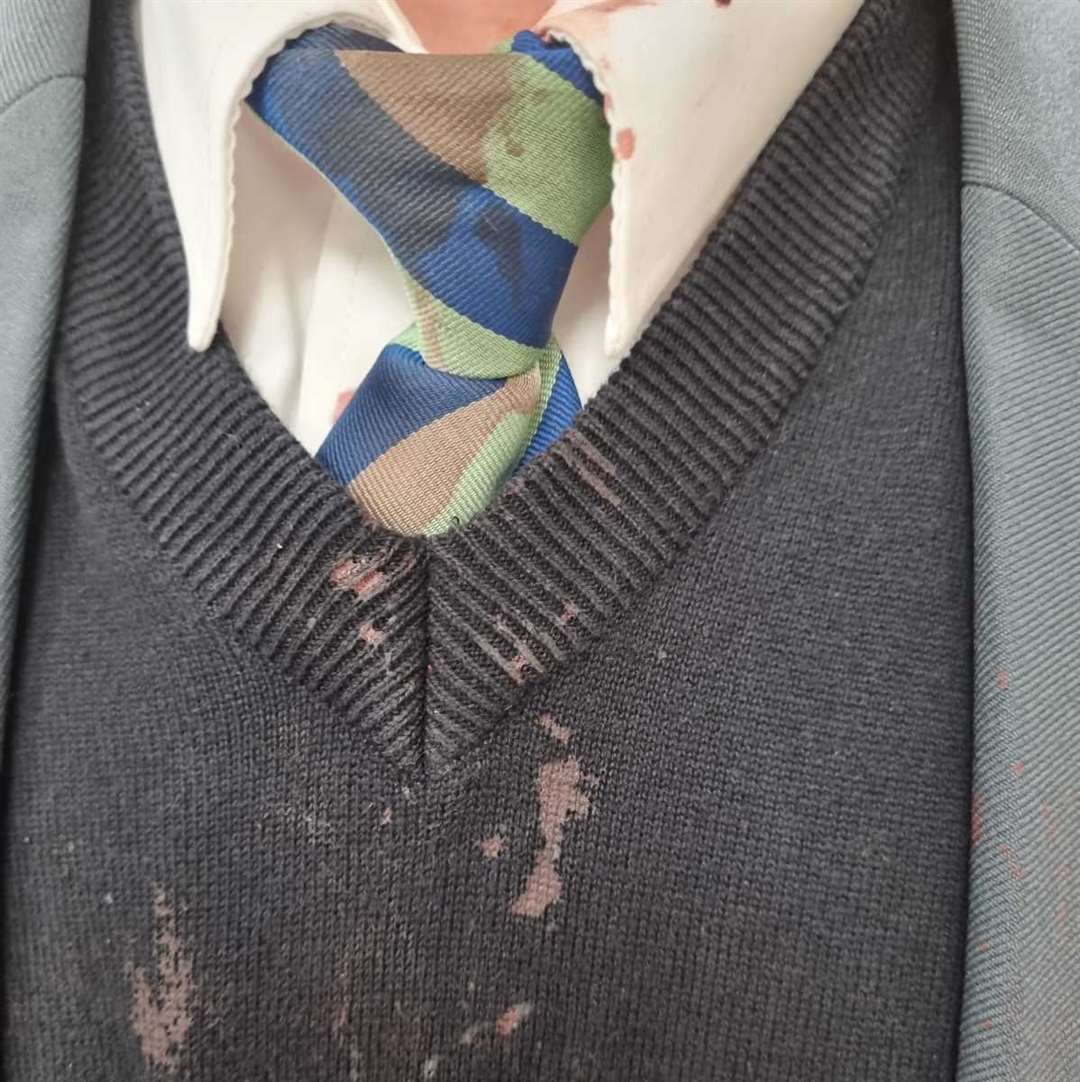 His school uniform was covered in blood. Picture: Stephanie Parsons