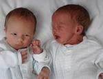 Aaron and Todd Furnell soon after they were born