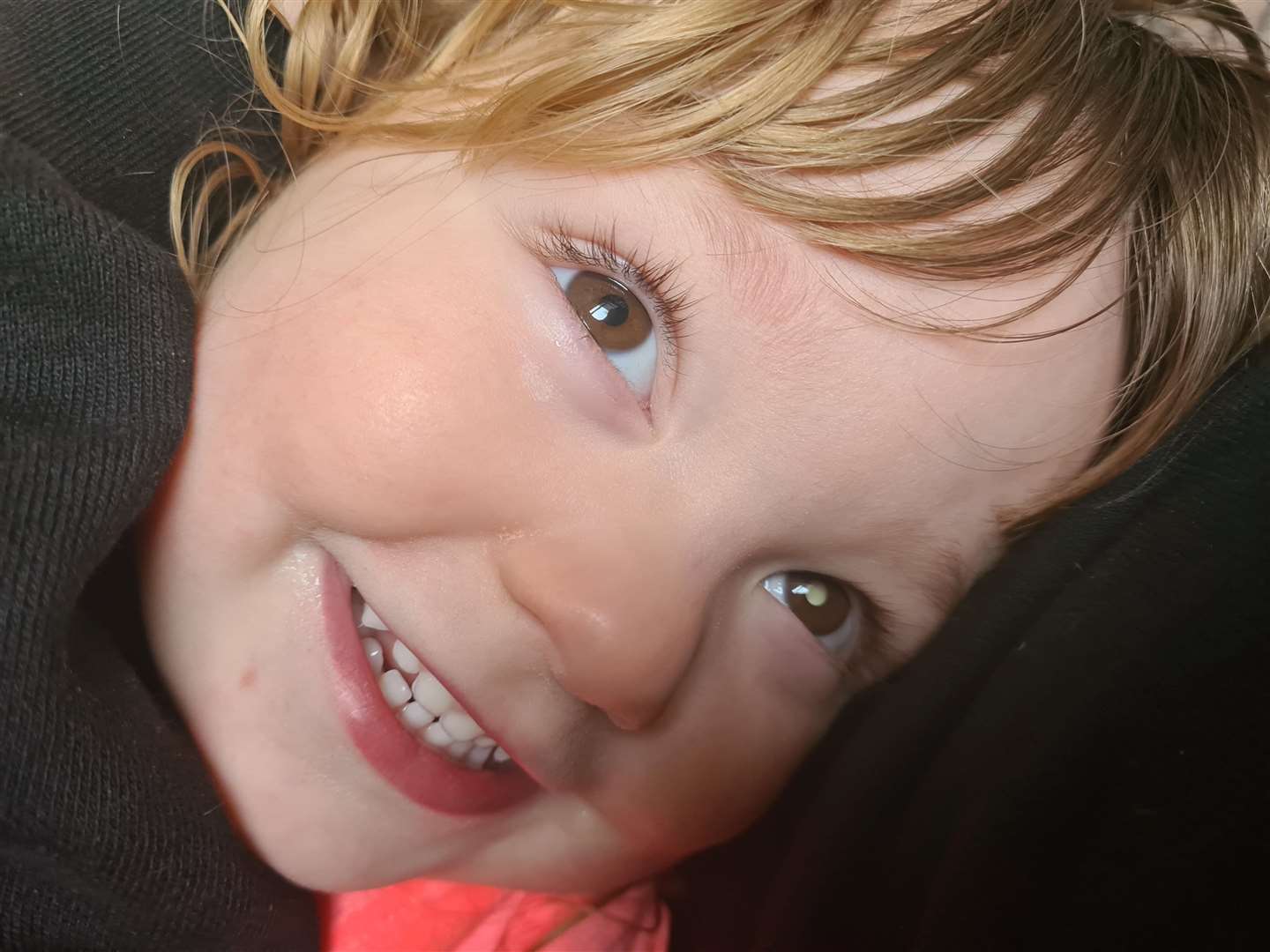 Darcey-Rose Hickson with the white glow in her eye - which proved to be the first sign of the cancer. Picture: SWNS