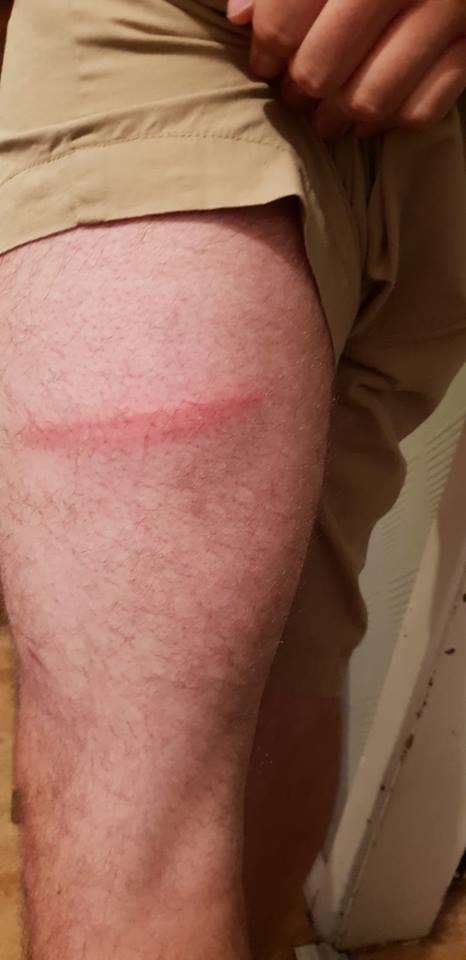 A teenage boy from Gravesend was left with bruises after being assaulted with a baton. (2444688)