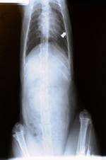 An X-ray of where Binny the cat got shot by an airgun pellet