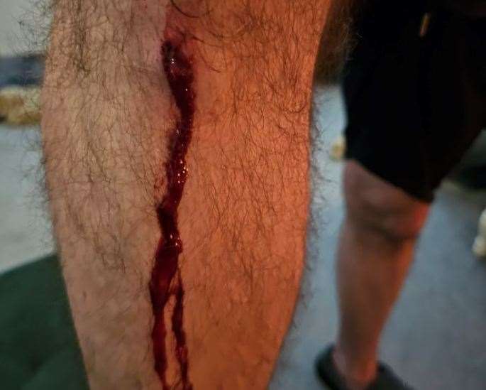 The veteran's injured leg