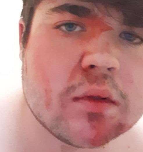 Barnaby Harrison was covered in a red substance after the attack