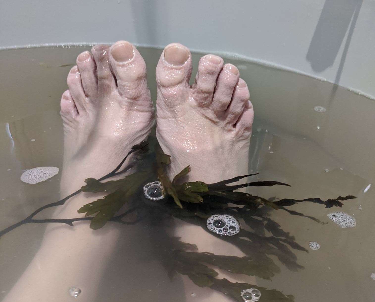Martin Hunt shows of the effect on his feet after seven hours in the bath