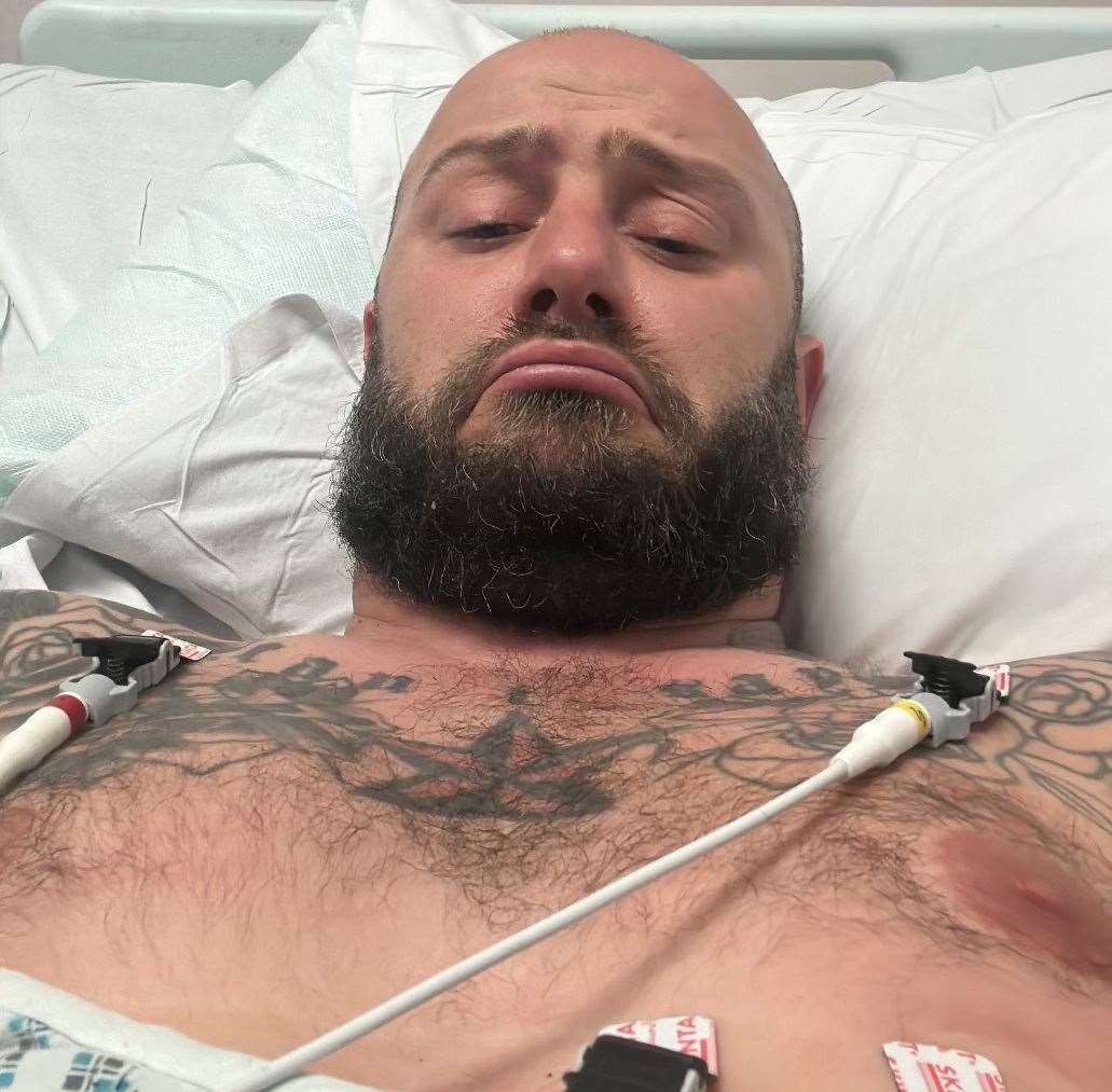 Darren Crooks who crashed after hitting a pothole underwent nine hours of surgery for multiple injuries in his legs. Picture: Darren Crooks