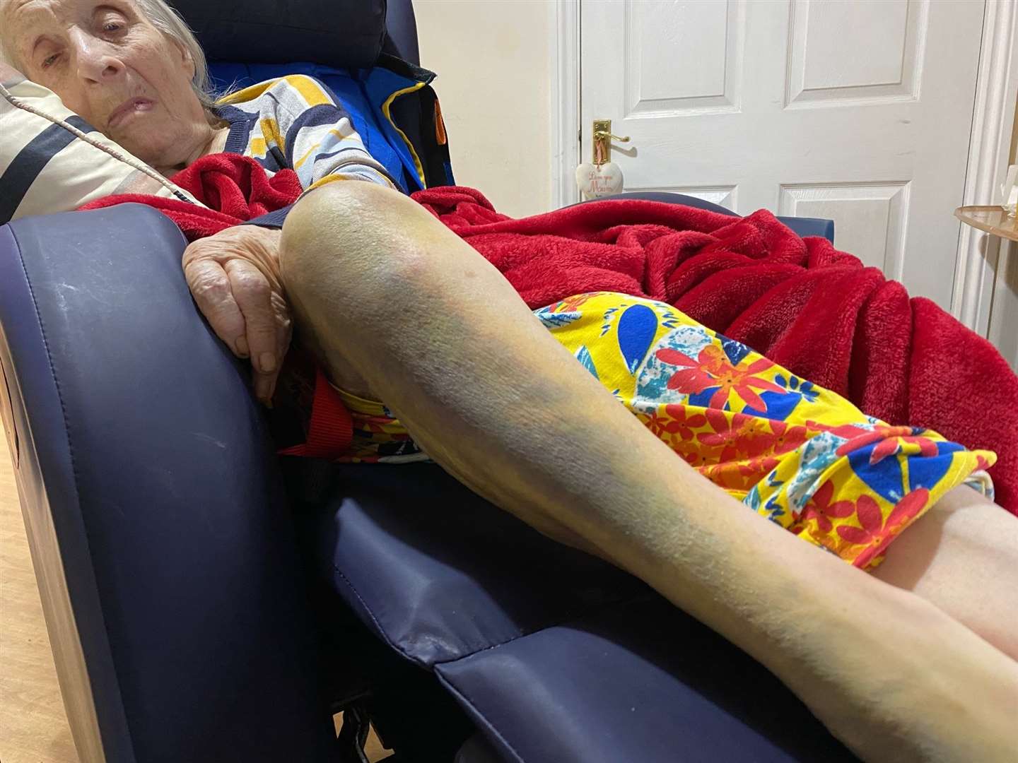 Maureen Snelling broke her leg at Grace Manor Care Home in Gillingham Picture: Peter Snelling
